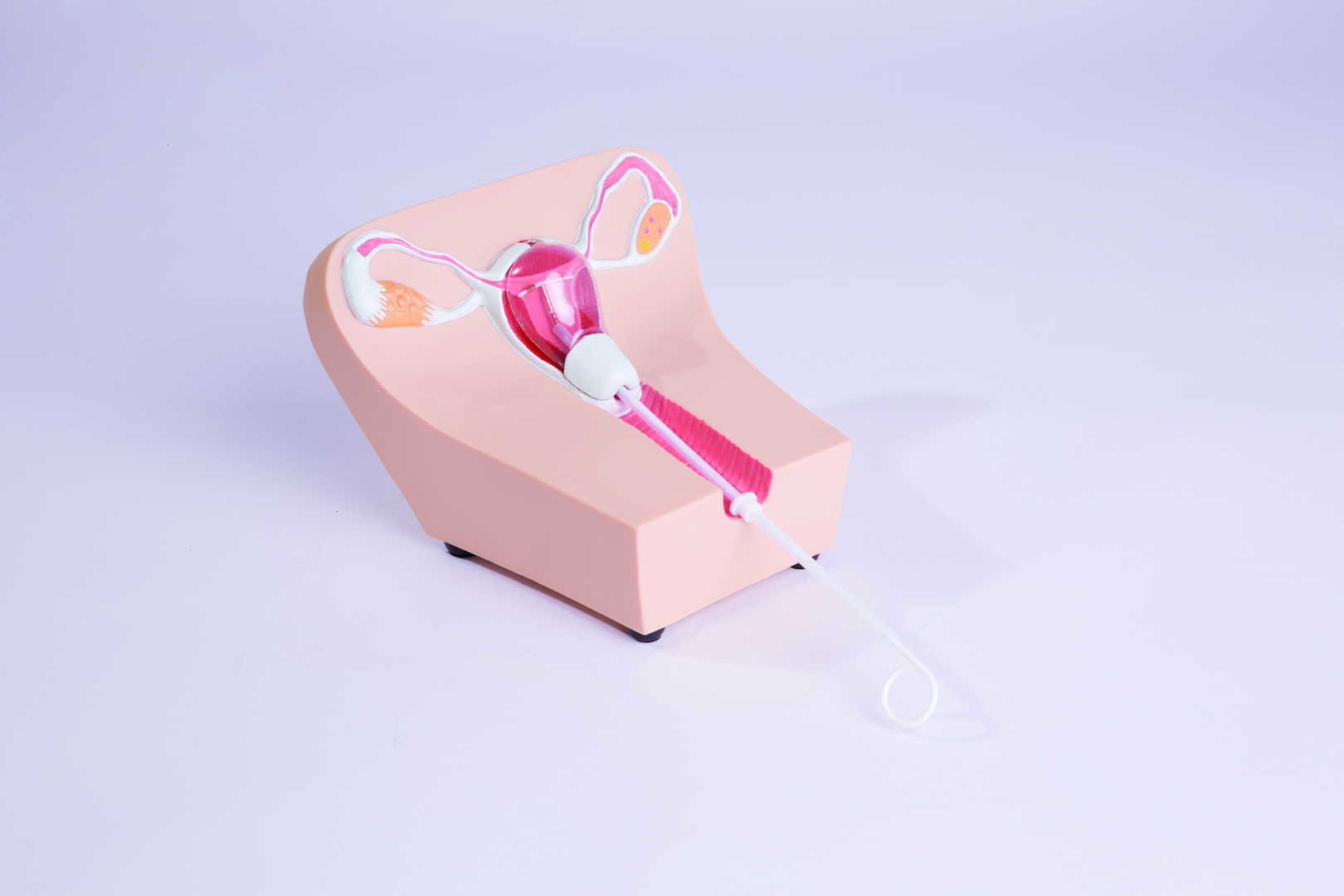 IUD Insertion Model I