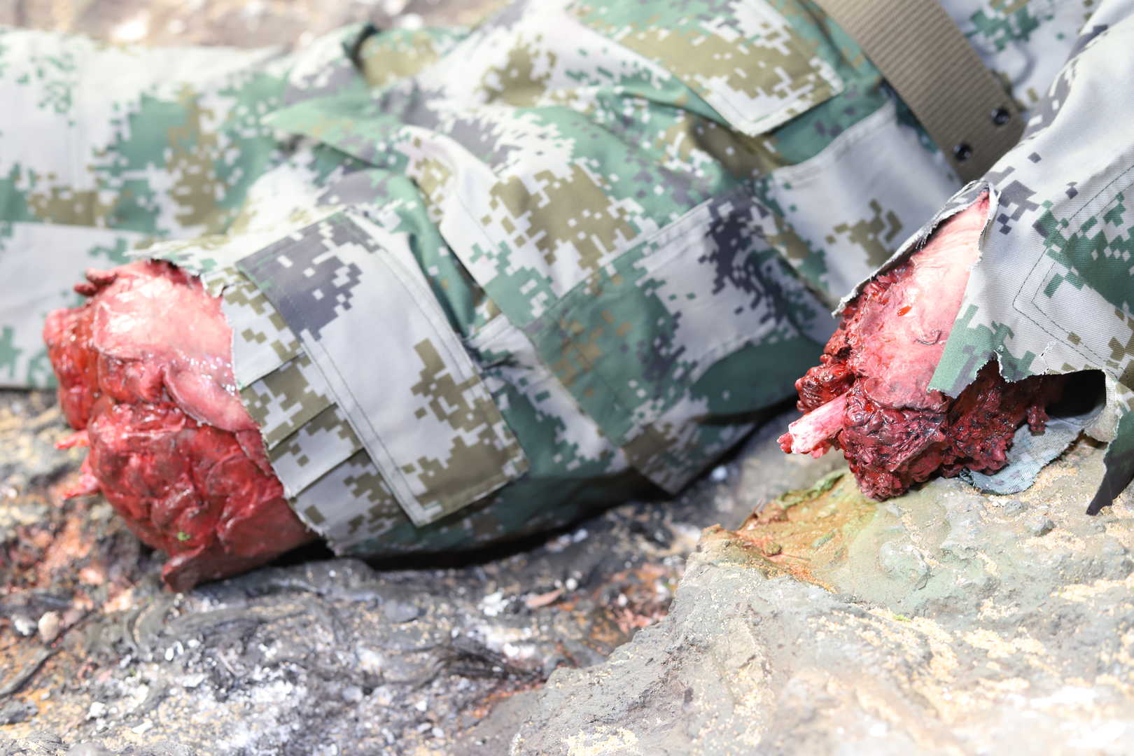 Wearable Blast Wound Kit